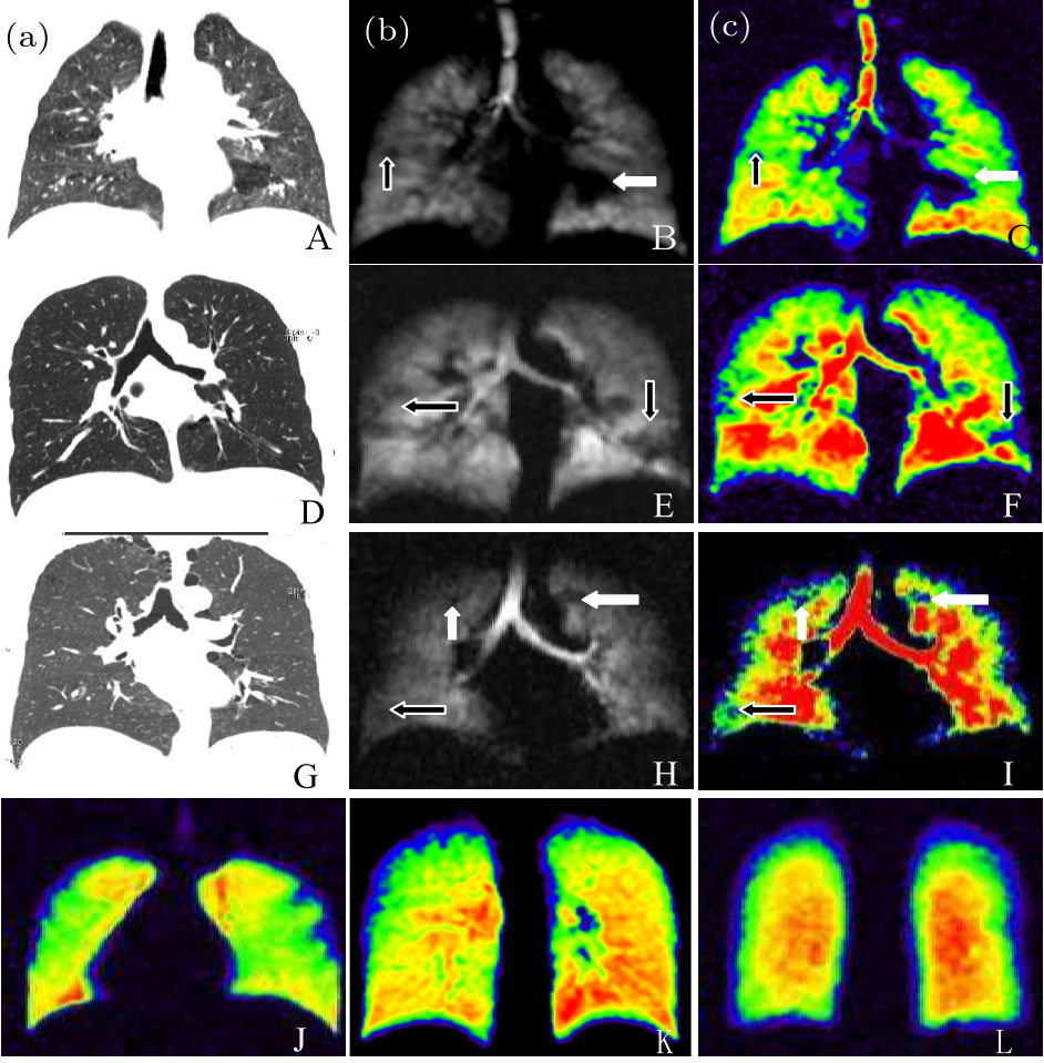 cpl-35-5-058701-fig1.png